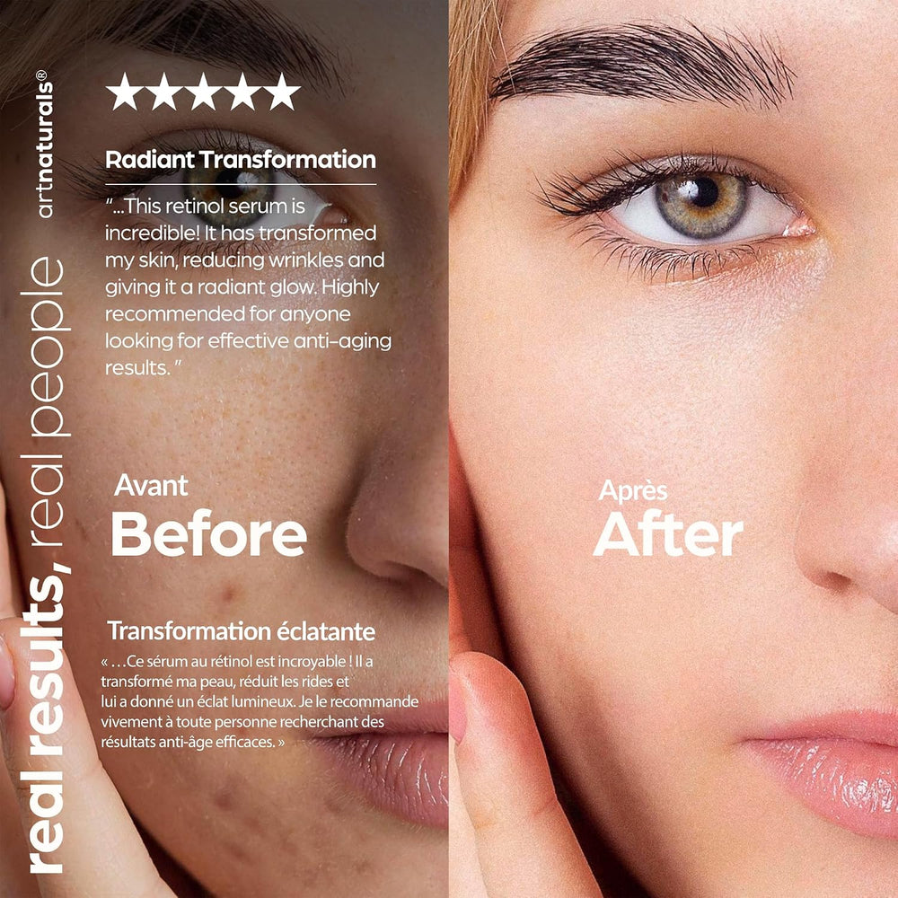 Retinol Serum  1 oz