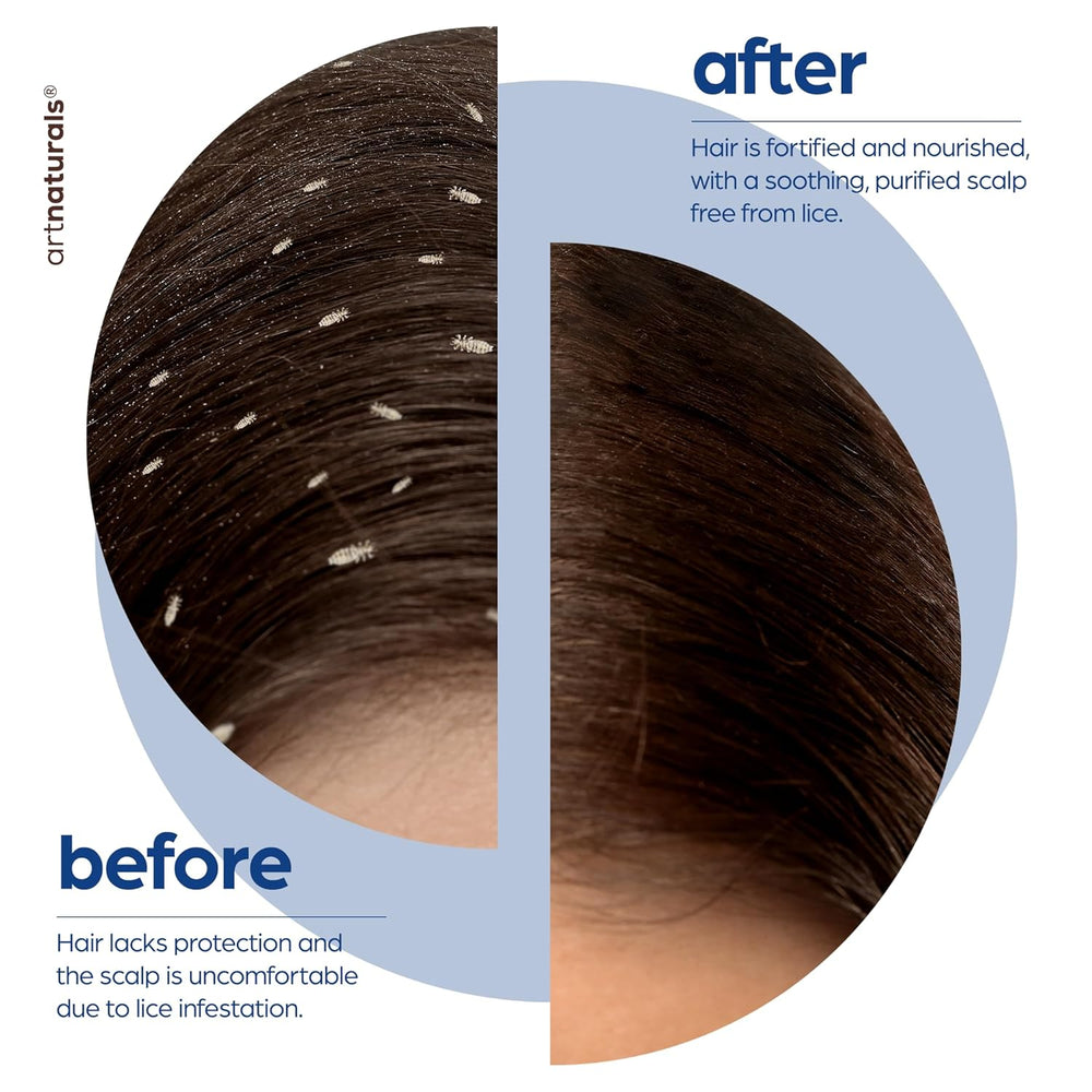 Lice Prevention Shampoo, product detail